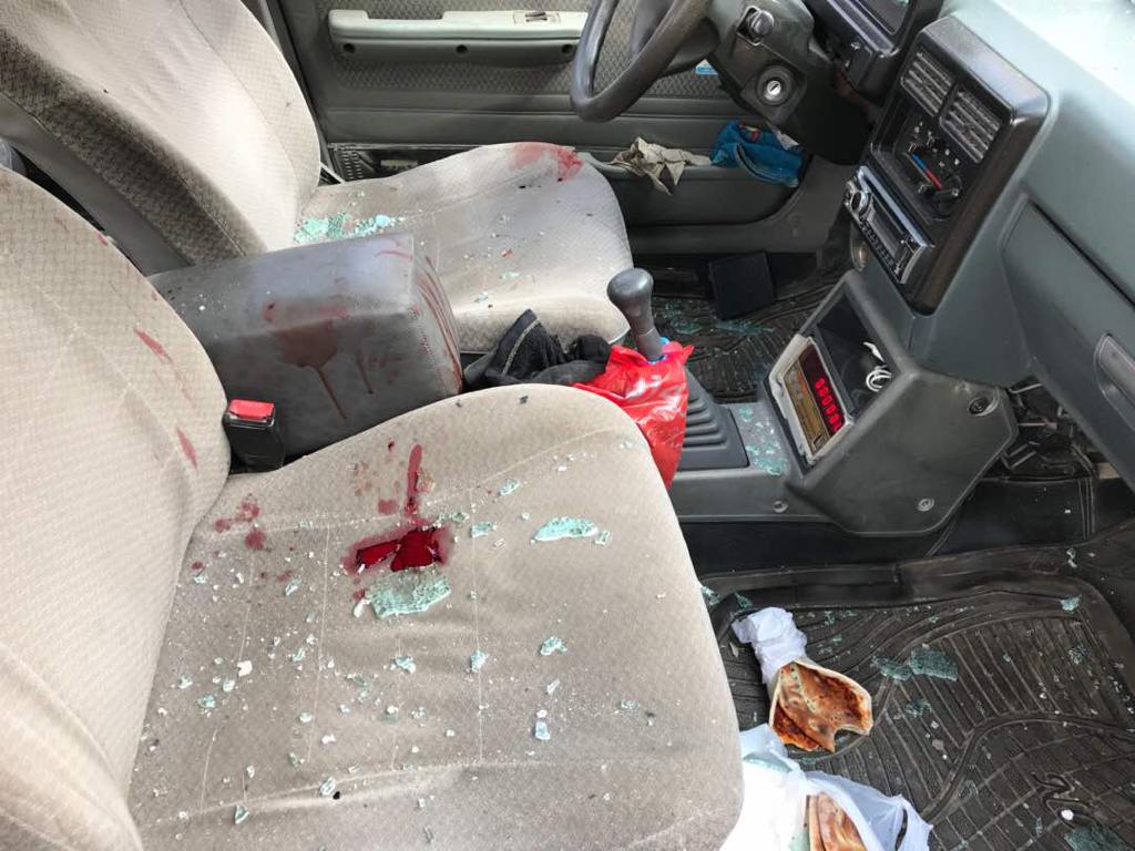 Rockets hit near Afrin Hospital in Syrian Kurdistan (Rojava), Feb. 13, 2018. (Photo: Kurdistan 24)